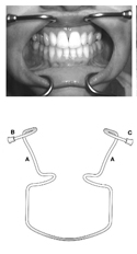 Oringer Retractor Large